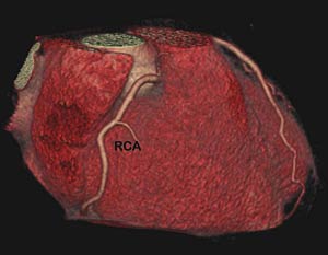 Fig1-A