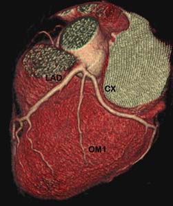 Fig1-C
