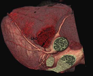 Fig2-A