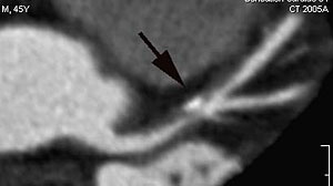 Fig2-B