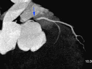 Fig3-A